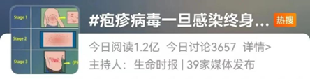带状疱疹—中老年养生不可忽视的皮肤疾病(图1) 1.png